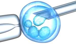 Injectia Intracitoplasmatica A Spermei In Ovul